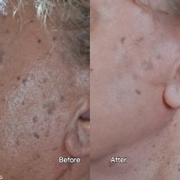 Thesauros Brightening & Anti-Aging Night Cream Gel 30ml Thesauros Brightening & Anti-Aging Night Cream Gel 30ml