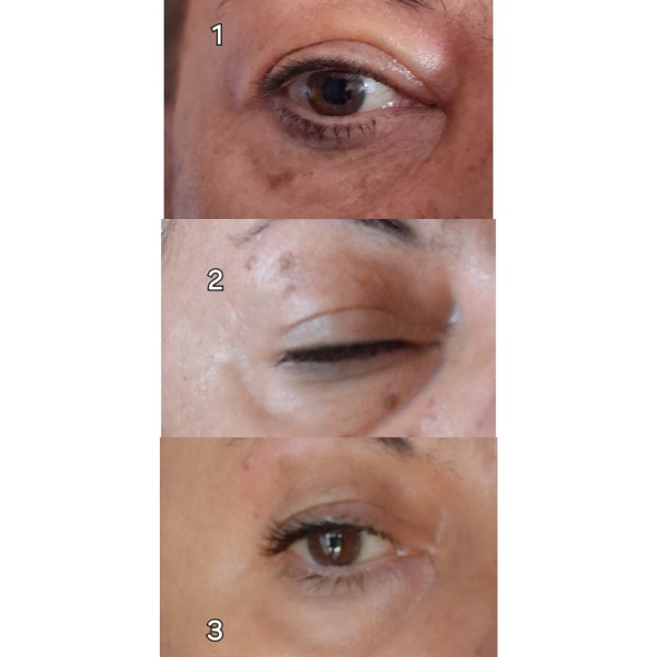 Magnificent Eye Corrector Formula 20ml + Δώρο Reusable Silicone Eye Patches  Magnificent Eye Corrector Formula 20ml + Δώρο Reusable Silicone Eye Patches
