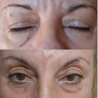 Correct & Revive Eye Renewal Duo