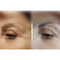 Correct & Revive Eye Renewal Duo