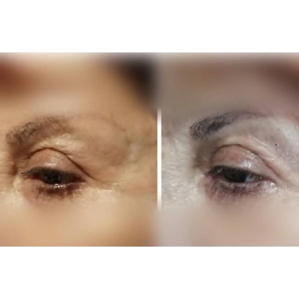 Correct & Revive Eye Renewal Duo