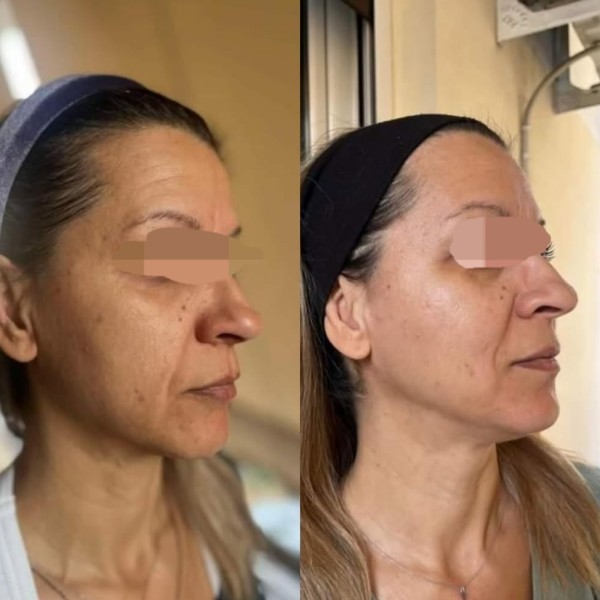 Thesauros Advanced Night gel serum Brightening Dark spot care Anti-aging 30ml