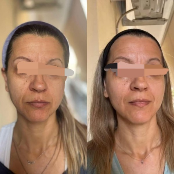 Thesauros Advanced Night gel serum Brightening Dark spot care Anti-aging 30ml