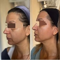 Thesauros Advanced Night gel serum Brightening Dark spot care Anti-aging 30ml