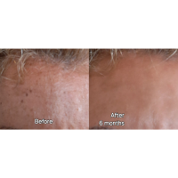 Thesauros Brightening & Anti-Aging Night Cream Gel 30ml Thesauros Brightening & Anti-Aging Night Cream Gel 30ml