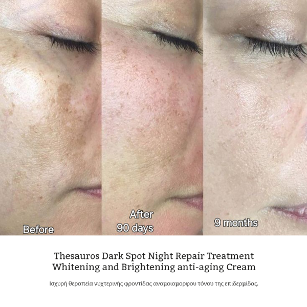 Thesauros Brightening & Anti-Aging Night Cream Gel 30ml Thesauros Brightening & Anti-Aging Night Cream Gel 30ml